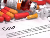 The Relationship Between Uric Acid and Gout