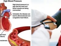 How At-Home Blood Pressure Monitoring Can Lower Blood Pressure Levels