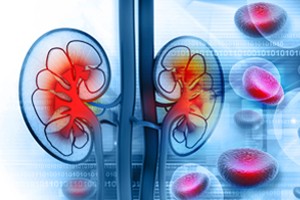 10 Natural Ways to Control Uric Acid