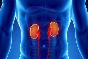 7 Things You Need to Know About Kidney Stone Development