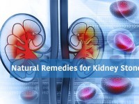 10 Natural Remedies for Kidney Stones
